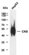 Western Blot (WB): HepG2 whole cell lysates were separated by 10% SDS-PAGE, and the membrane was blotted with anti-CK8 STJA0039057