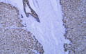 Immunohistochemistry (IHC): Human liver tissue was stained with Anti-Cytokeratin 8 (ABT537) Antibody. STJA0039059