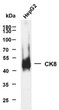 Western Blot (WB): HepG2 whole cell lysates were separated by 10% SDS-PAGE, and the membrane was blotted with anti-CK8 STJA0039060