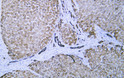 Immunohistochemistry - Paraffin (IHC-P): Human liver tissue was stained with Anti-Cytokeratin 8 (ABT534) Antibody. STJA0039060