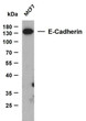 Western Blot (WB): Whole cell lysates were separated by 15% SDS-PAGE, and the membrane was blotted with anti-E-cadherin STJA0039062