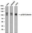 Western Blot (WB): Various whole cell lysates were separated by 8% SDS-PAGE, and the membrane was blotted with STJA0039069