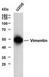 Western Blot (WB): U2OS whole cell lysates were separated by 10% SDS-PAGE, and the membrane was blotted with STJA0039073