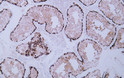 Immunohistochemistry - Paraffin (IHC-P): Human testis tissue was stained with Anti-MAGE-C1 (ABT339) antibody. STJA0039075
