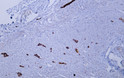 Immunohistochemistry - Paraffin (IHC-P): Human appendix tissue was stained with Anti-Neurofilament (ABT456) antibody. STJA0039081