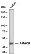 Western Blot (WB): Whole cell lysates of LNCaP were separated by 8% SDS-PAGE, and the membrane was blotted with STJA0039084