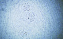 Immunohistochemistry - Paraffin (IHC-P): Human kidney tissue was stained with Anti-p57kip2 (ABT-P57) Antibody. STJA0039093