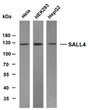 Western Blot (WB): Various whole cell lysates were separated by 10% SDS-PAGE, and the membrane was blotted with STJA0039096