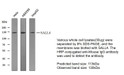 Western blot analysis of SALL4 Antibody at 1:1000 dilution. STJA0039096