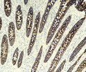 Immunohistochemistry - Paraffin (IHC-P): Human appendix tissue was stained with Anti-Cytokeratin 19 (ABT010) Antibody. STJA0039098