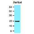 Western blot of human BID protein in Jurkat cell lysate using anti-human BID antibody STJA0041465