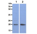 Western blot of human BID antibody STJA0041465 in HeLa and A549 cell lysates