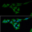 ICC IF of Crystallin alpha B in HeLa cells stained with STJA0041471 antibody