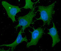 ICC IF of Cofilin 1 in HeLa cells with STJA0041479 antibody and Alexa Fluor 488