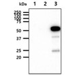 Western blot of human EphA2 antibody in 293T cell lysates with extracellular and cytoplasmic domains