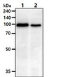 Western blot of human Hexokinase 1 2 protein in K562 and Jurkat cell lysates using STJA0041497 antibody