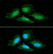 ICC IF of PPP1CA in HeLa cells with STJA0041532 antibody Alexa Fluor 488 green staining DAPI blue nuclear counterstain