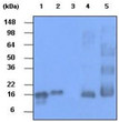 Western blot of human synuclein proteins probed with anti-HSP60 antibody showing recombinant and tissue lysate samples
