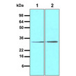 Western blot of human STEAP1 antibody showing LNcap cell lysate and mouse testis tissue lysate