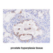 Human STEAP1 antibody immunohistochemistry staining showing tissue-specific expression patterns