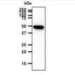 Western blot of human PEDFR PNPLA2 ATGL protein in A431 cell lysate using STJA0041546 antibody