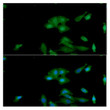 ICC IF of IL-6 in A549 cells stained with STJA0041547 antibody Alexa Fluor 488 secondary antibody green and DAPI nuclear stain blue