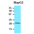 Western blot of human RBP4 protein in HepG2 cell lysate using anti-RBP4 antibody