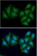 ICC IF staining of Casein Kinase 1 alpha in HeLa cells with STJA0041567 antibody Alexa Fluor 488 green DAPI blue