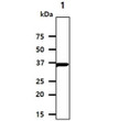 Western blot of human Casein Kinase 1 alpha CSNK1A1 in Jurkat cell lysate