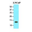 Western blot of human TBCA antibody showing LNCaP cell lysate detection with anti-mouse HRP secondary