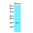 Western blot of human CRABP1 antibody detection in mouse eye tissue lysate