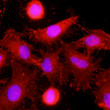 Immunofluorescence of human HeLa cells stained with anti-CLEC4E antibody and Hoechst nuclear stain