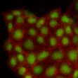 Immunofluorescence of human MCF7 cells with anti-MAPK1 antibody and Phalloidin-TRITC staining