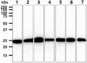 Western blot of human BAK antibody across 7 cell lines using anti-mouse HRP and ECL detection