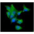 ICC IF of CAV1 in A549 cells stained with Caveolin-1 antibody and Alexa Fluor 488