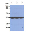 Western blot of human eIF2 alpha EIF2S1 protein in HeLa Jurkat and NIH-3T3 cell lysates