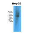 Western blot of human TPMT protein using STJA0041613 antibody with HRP detection