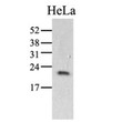 Western blot of human Cyclophilin C PPIC protein in HeLa cell lysate using STJA0041620 antibody