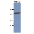 Western blot of mouse kidney lysate probed with anti-human CNDP2 CPGL antibody