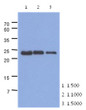 Western blot of human TNNI1 antibody detection in mouse muscle extract