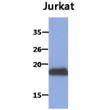 Western blot of human MafK protein in Jurkat cell lysate using anti-MafK antibody