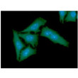 ICC IF of TBCB in HeLa cells with DAPI nuclear staining and Alexa Fluor 488 detection
