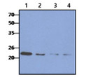 Western blot of human CRADD antibody in A549 HeLa MCF-7 and 293T cell lysates