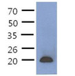 Western blot of human CD3E protein in Jurkat cell lysate using anti-CD3E antibody