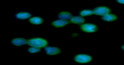 ICC IF of ALDOC in Jurkat cells with Alexa Fluor 488 and DAPI staining