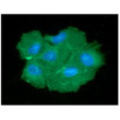ICC IF of PGAM2 in Hep3B cells stained with STJA0041773 antibody and Alexa Fluor 488