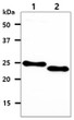 Western blot of human p27 Kip1 CDKN1b protein in MCF-7 and NIH 3T3 cell lysates