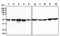 Western blot of human GSS antibody STJA0041796 across 10 cell lines using anti-mouse HRP detection
