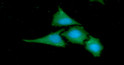 Western blot of Human BAG2 antibody STJA0041812 showing protein detection