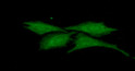 ICC IF of B2M in HeLa cells with DAPI nuclear staining and Alexa Fluor 488 visualization